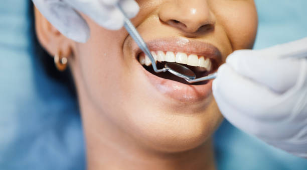 Best Emergency Root Canal Treatment in Victoria, VA