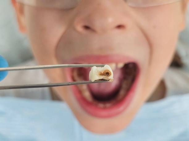 Best Urgent Dental Care for Toothache in Victoria, VA