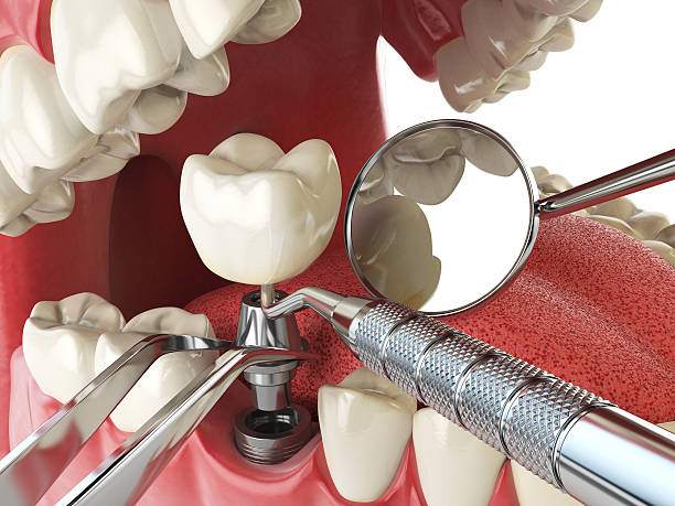 Best Broken or Cracked Tooth Emergency Dentist in Victoria, VA